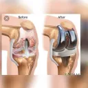 طب العظام بالهندكل خدمة