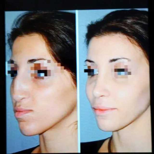 تجميل اسطنبول - مجموعة واتساب